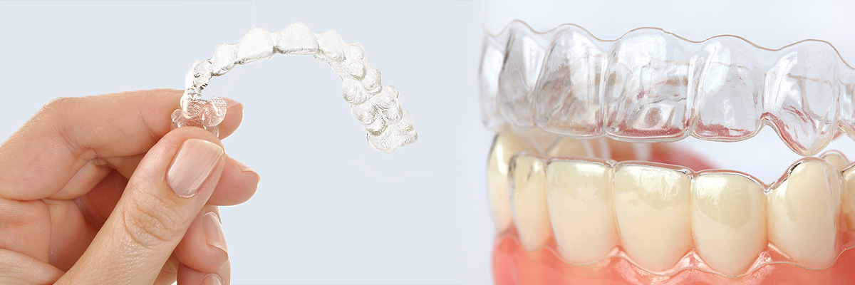 Hawthorne Alternative to Braces for Teens