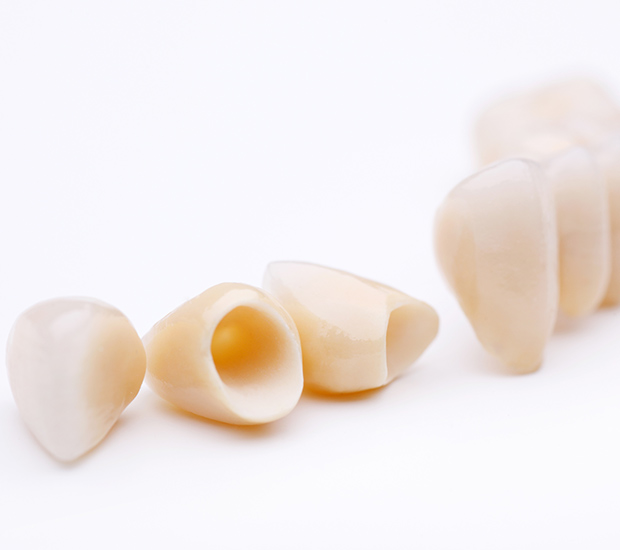 Hawthorne Dental Crowns and Dental Bridges