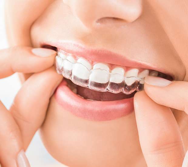 Hawthorne Does Invisalign® Really Work?