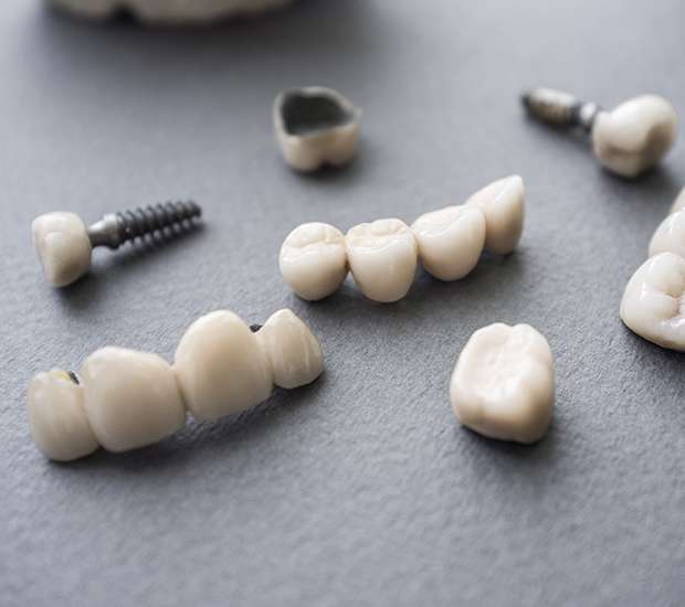 Hawthorne The Difference Between Dental Implants and Mini Dental Implants