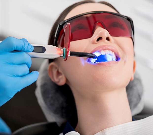 Hawthorne Professional Teeth Whitening