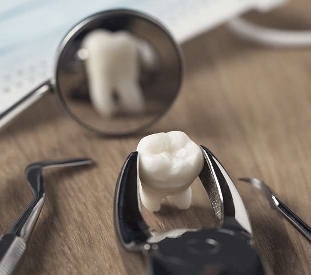 Hawthorne When Is a Tooth Extraction Necessary